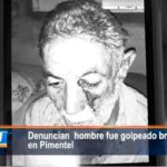 [Video] Denuncian hombre fue golpeado brutalmente en Pimentel